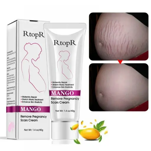 Anti-Stretch Marks Cream